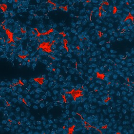 CXCL13 Antibody in Immunohistochemistry (Frozen) (IHC (F))