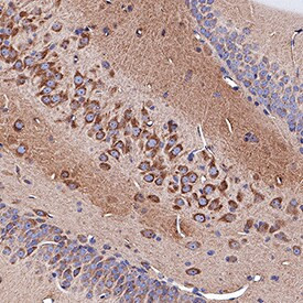 Neuropilin 1 Antibody in Immunohistochemistry (Paraffin) (IHC (P))