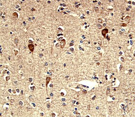 TROP2 Antibody in Immunohistochemistry (Paraffin) (IHC (P))