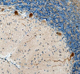 ADAMTS8 Antibody in Immunohistochemistry (Paraffin) (IHC (P))