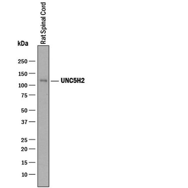 UNC5B Antibody in Western Blot (WB)