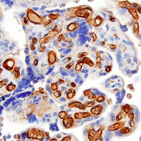 CD153 Antibody in Immunohistochemistry (Paraffin) (IHC (P))