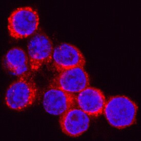 Cathepsin D Antibody in Immunocytochemistry (ICC/IF)