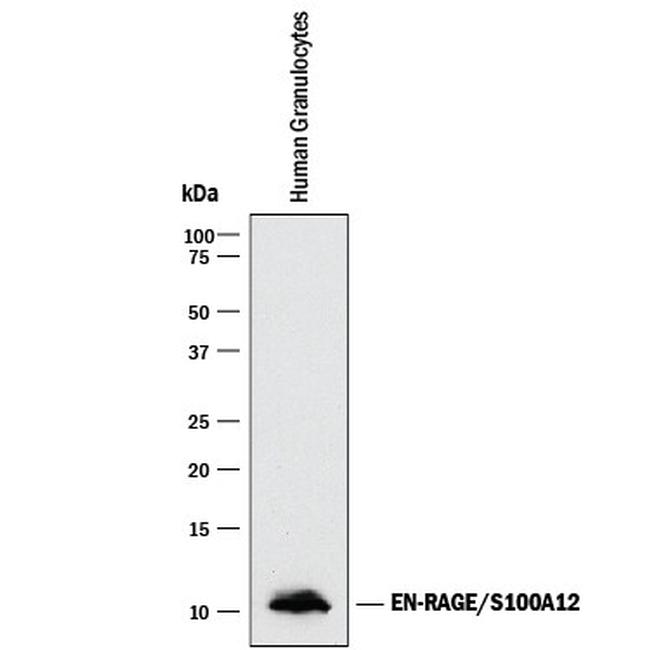 S100A12 Antibody in Western Blot (WB)