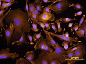 TROP2 Antibody in Immunocytochemistry (ICC/IF)