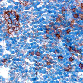 Cathepsin S Antibody in Immunohistochemistry (Paraffin) (IHC (P))