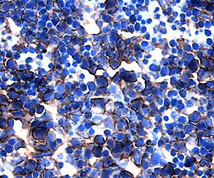 NOTCH2 Antibody in Immunohistochemistry (Frozen) (IHC (F))