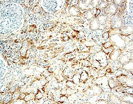 IL17RB Antibody in Immunohistochemistry (Paraffin) (IHC (P))