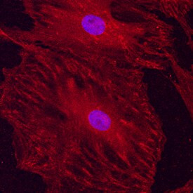 CD51 Antibody in Immunocytochemistry (ICC/IF)