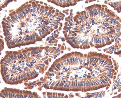 SERPINF2 Antibody in Immunohistochemistry (Frozen) (IHC (F))