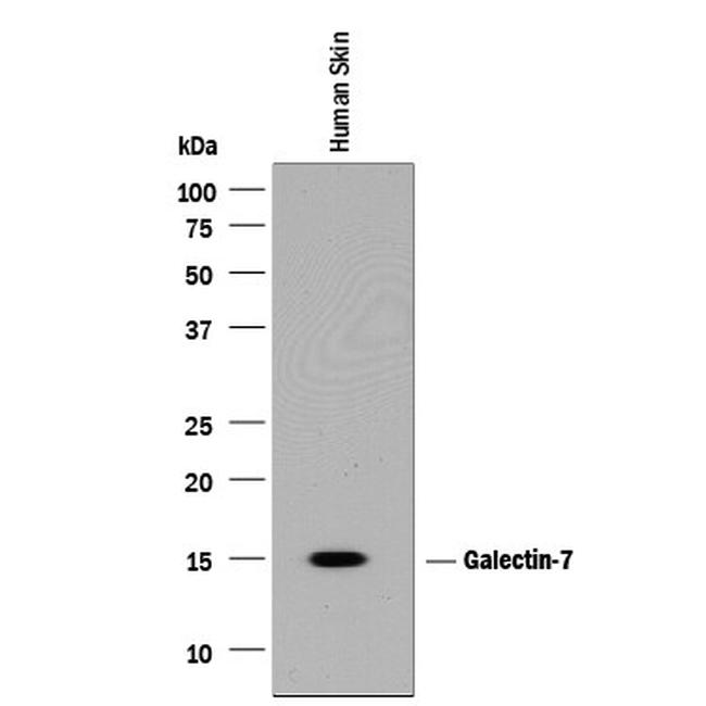 Galectin 7 Antibody in Western Blot (WB)