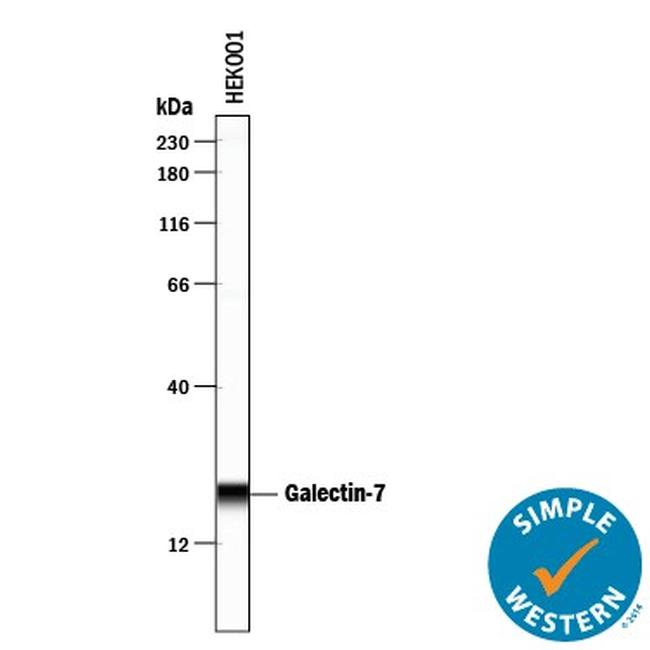 Galectin 7 Antibody in Western Blot (WB)