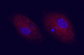 CD83 Antibody in Immunocytochemistry (ICC/IF)