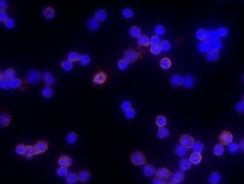 CD83 Antibody in Immunocytochemistry (ICC/IF)