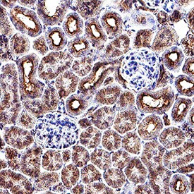 PDGF-C Antibody in Immunohistochemistry (Paraffin) (IHC (P))