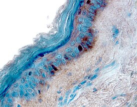 IL13RA1 Antibody in Immunohistochemistry (Paraffin) (IHC (P))