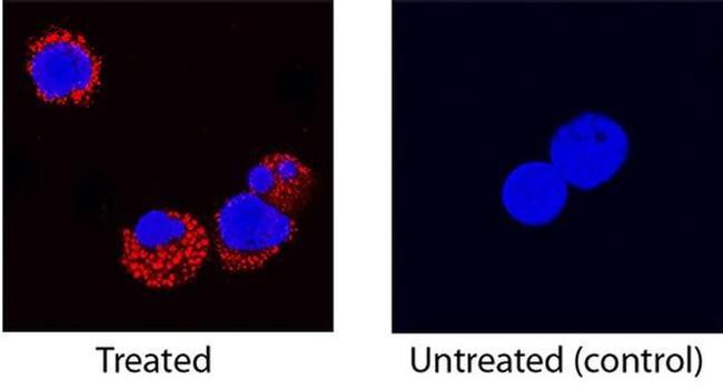 GM-CSF Antibody