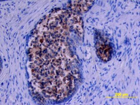 Kallikrein 11 Antibody in Immunohistochemistry (Paraffin) (IHC (P))