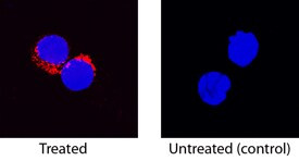 IL-8 (CXCL8) Antibody in Immunocytochemistry (ICC/IF)