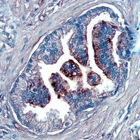 NOV Antibody in Immunohistochemistry (Paraffin) (IHC (P))