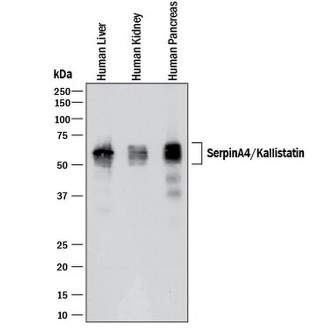 SERPINA4 Antibody in Western Blot (WB)