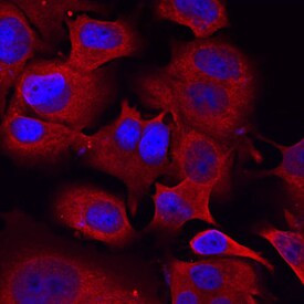 SEMA3C Antibody in Immunocytochemistry (ICC/IF)