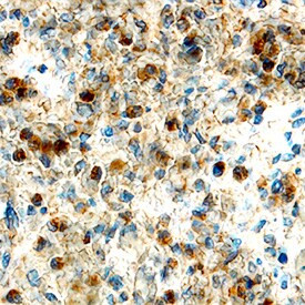 CD267 (TACI) Antibody in Immunohistochemistry (Paraffin) (IHC (P))