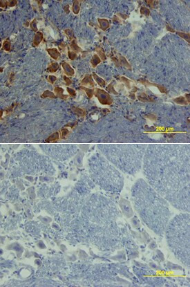 ROBO1 Antibody in Immunohistochemistry (Frozen) (IHC (F))