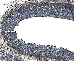 ROBO1 Antibody in Immunohistochemistry (Frozen) (IHC (F))