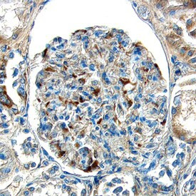 ECE1 Antibody in Immunohistochemistry (Paraffin) (IHC (P))