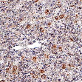 NKp46 Antibody in Immunohistochemistry (Paraffin) (IHC (P))