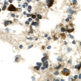 FGFR5 Antibody in Immunohistochemistry (Frozen) (IHC (F))