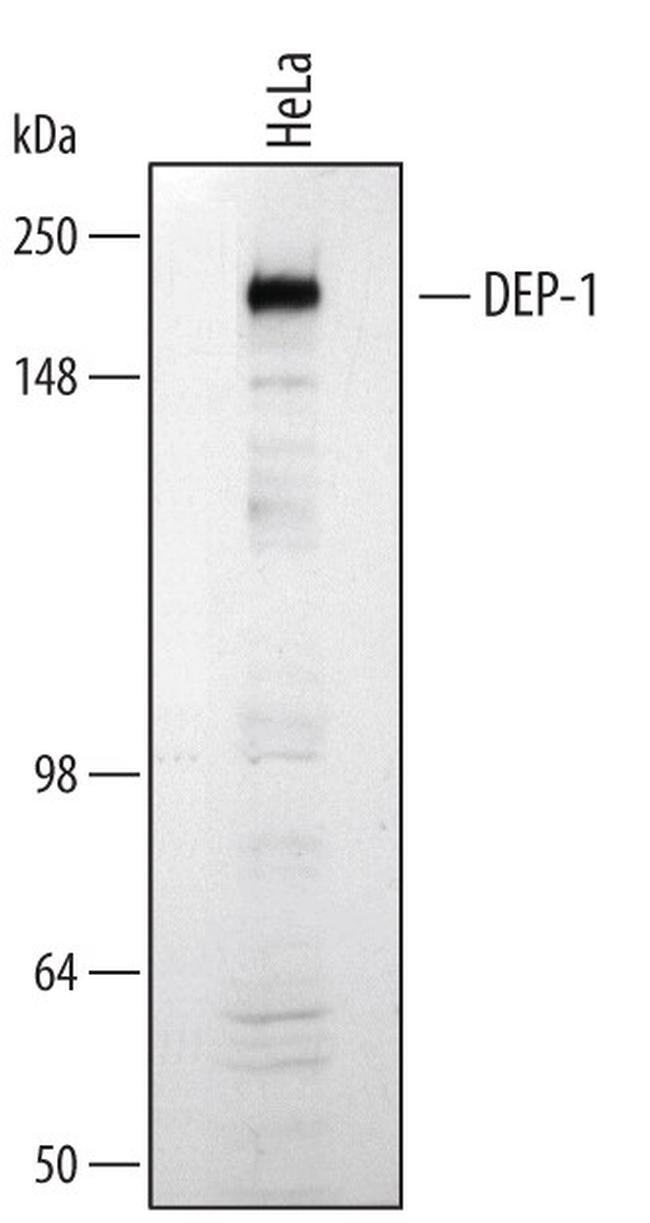 CD148 Antibody in Western Blot (WB)