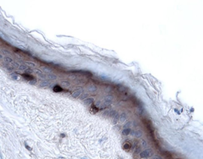 Langerin Antibody in Immunohistochemistry (Paraffin) (IHC (P))