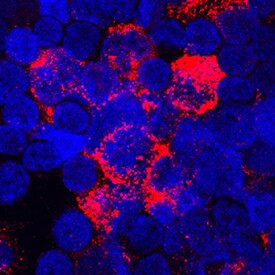 TNFAIP6 Antibody in Immunocytochemistry (ICC/IF)