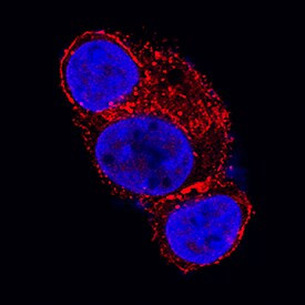 Glypican 3 Antibody in Immunocytochemistry (ICC/IF)