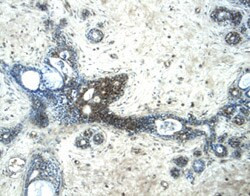 Glypican 3 Antibody in Immunohistochemistry (Paraffin) (IHC (P))