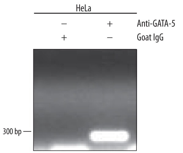 GATA5 Antibody in ChIP Assay (ChIP)