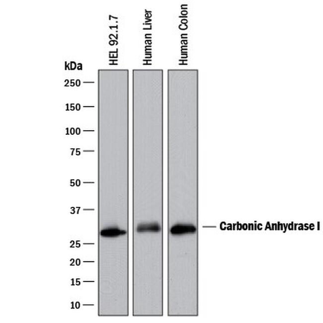 Carbonic Anhydrase I Antibody in Western Blot (WB)