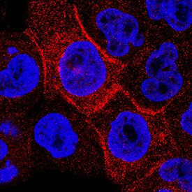 Carbonic Anhydrase IX Antibody in Immunocytochemistry (ICC/IF)