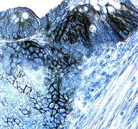 Carbonic Anhydrase IX Antibody in Immunohistochemistry (Paraffin) (IHC (P))