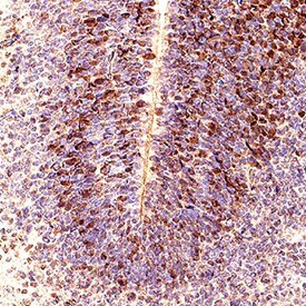 ASCL1 Antibody in Immunohistochemistry (Paraffin) (IHC (P))