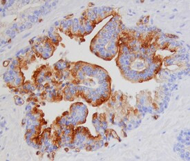 Kallikrein 13 Antibody in Immunohistochemistry (Paraffin) (IHC (P))