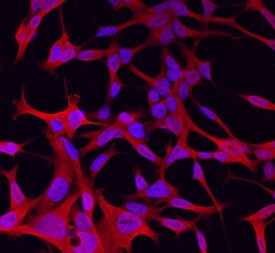 WNT11 Antibody in Immunocytochemistry (ICC/IF)