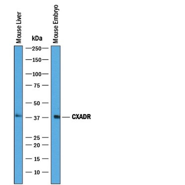 CAR Antibody in Western Blot (WB)