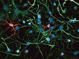 Nestin Antibody in Immunocytochemistry (ICC/IF)