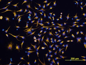 Nestin Antibody in Immunocytochemistry (ICC/IF)