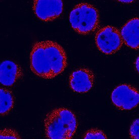 IL31RA Antibody in Immunocytochemistry (ICC/IF)