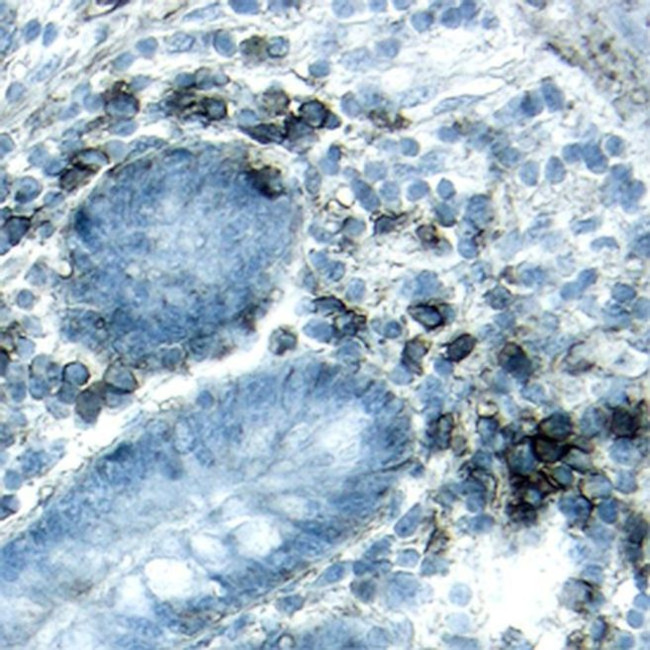 CD138 Antibody in Immunohistochemistry (Paraffin) (IHC (P))