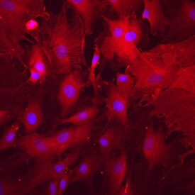 ALPL Antibody in Immunocytochemistry (ICC/IF)